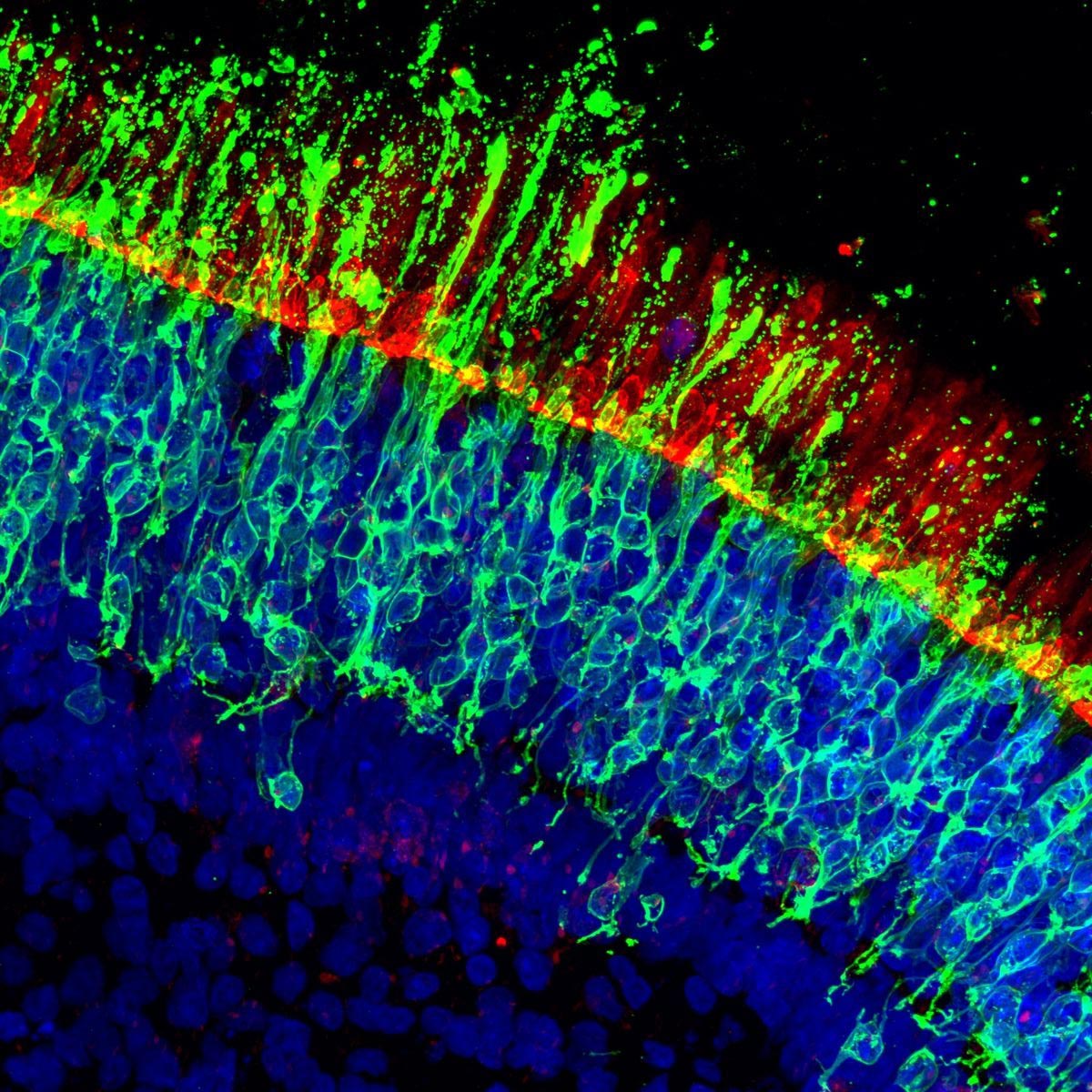 Naukowcy odkrywają, jak zatrzymać utratę wzroku, zanim się ona zacznie